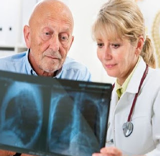 Mesothelioma forecast the ability of convalescing lives