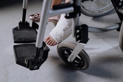 A picture of a patient in a wheelchair with broken ankles