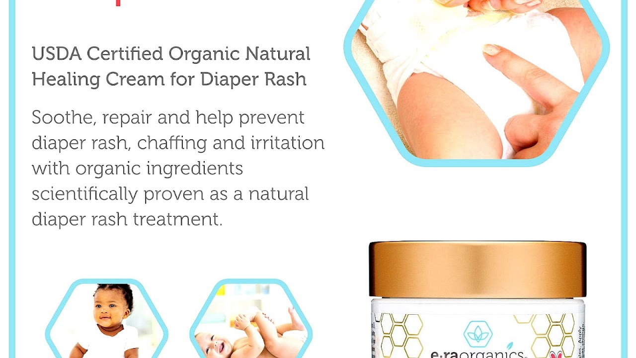 Irritant diaper dermatitis