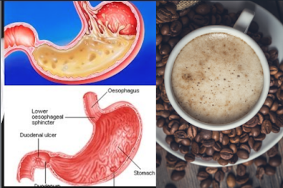 Effects of drinking Coffee,health tips