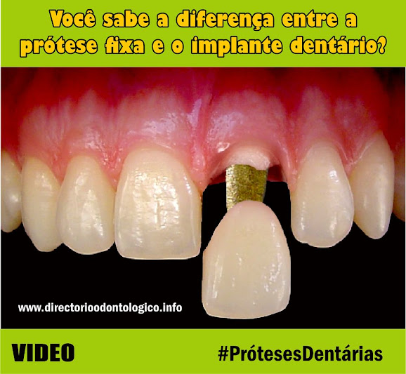 PRÓTESES DENTÁRIAS