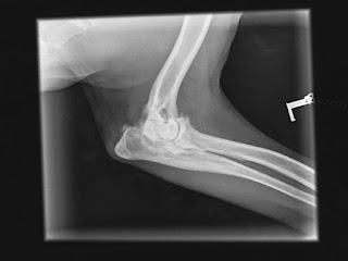 A photograph of an x-ray of Boris's left elbow joint, the arthritis makes the joint look fuzzy making it hard to confirm if there's a fracture or not