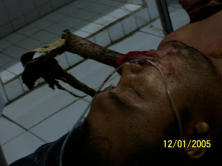 emergency room