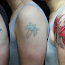 How to have a professional and friendly laser tattoo removal?