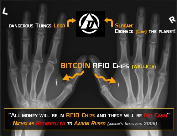 Bitcoin RFID Chip implants - hot Wallets