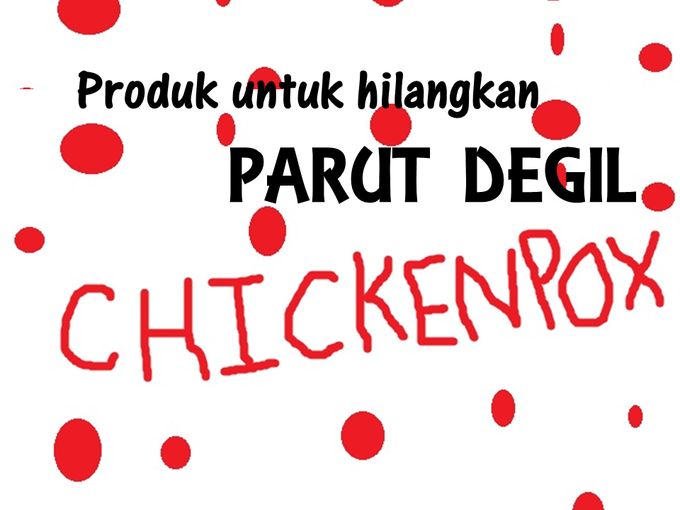 PRODUK UNTUK HILANGKAN PARUT DEGIL CHICKEN POX - Cantik 