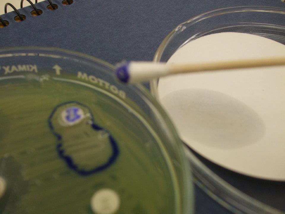 MicrobeDiscoveries: Oxidase Test
