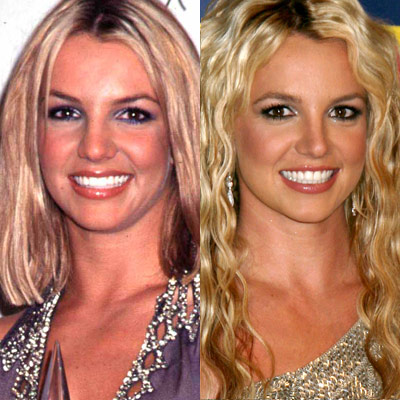 There was quite a scandal back in 2007 about Britney Spears' teeth