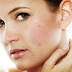 How to Remove Acne scars are disfiguring Facial Skin