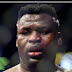 Francis Ngannou  in need of medicals treatment after fight with Anthony Joshua.