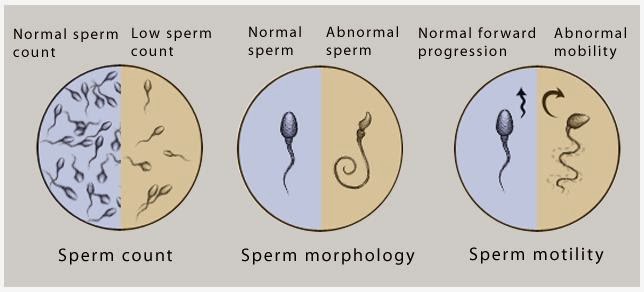 Obat Herbal Azoospermia Sperma Kosong