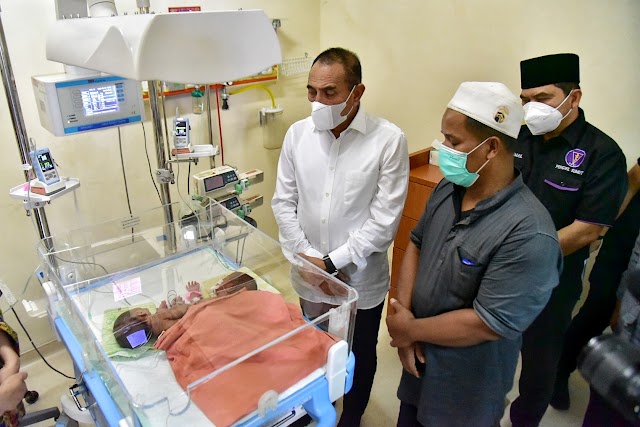 Gubernur Edy Rahmayadi Jamin Biaya Perobatan Bayi Kembar Siam asal Asahan