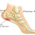 Heel pain – a sign of plantar fasciitis and what you can do about it