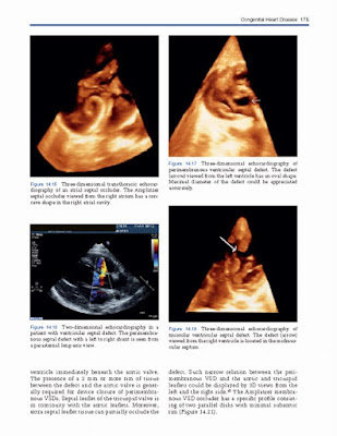 3D Echocardiography 2nd Edition