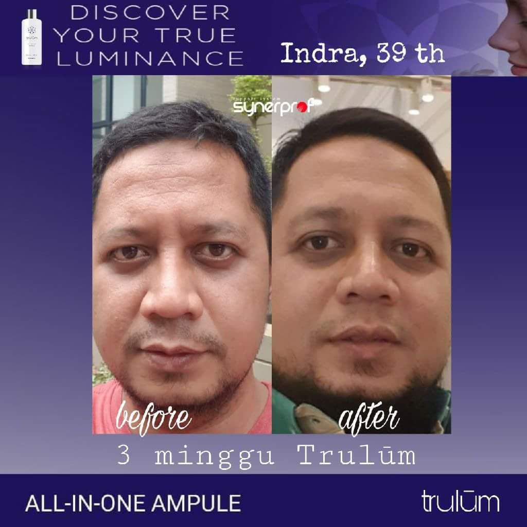 Jual Trulum All In One Ampoule Di Wilayah Bantarkalong, Tasikmalaya WA: 08112338376