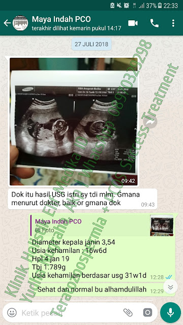 31+ Testimoni PCOS Dan AMH Rendah  Klinik Holistik Elif 