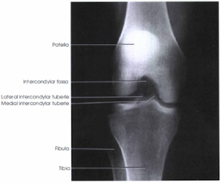 knee xray