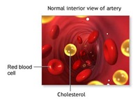 Cholesterol