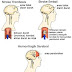 Mengenali jenis-jenis stroke