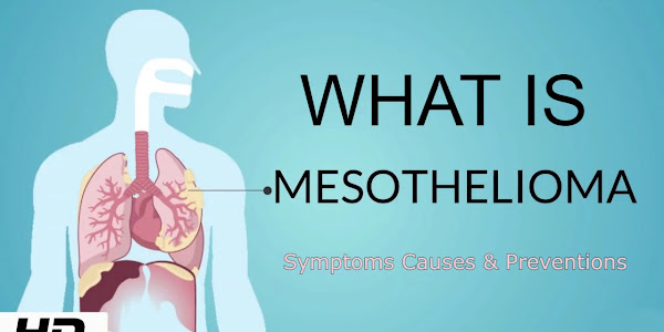 What is Mesothelioma 2023 | Its Symptoms Causes & Preventions