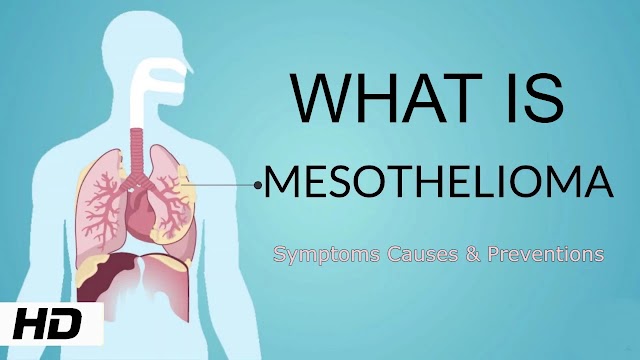 What is Mesothelioma 2023 | Its Symptoms Causes & Preventions