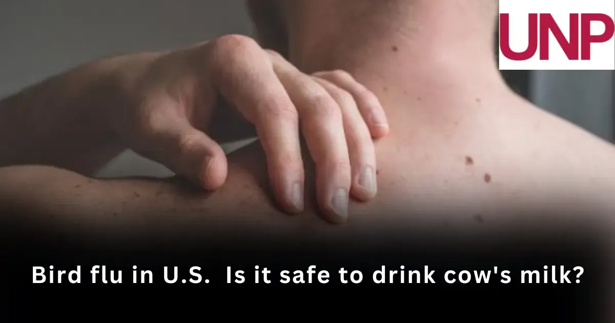 I thought my skin cancer was bite