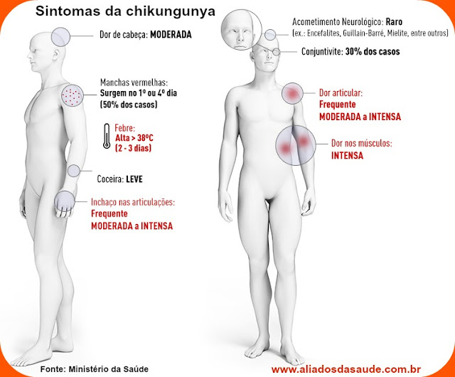 Chicungunha - Saiba mais sobre a doença que está assustando o Brasil