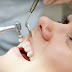 Lấy cao răng bằng máy siêu âm giá bao nhiêu?