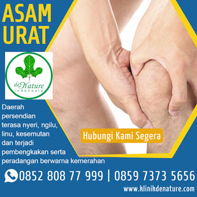 CARA ALAMI MENGOBATI PENYAKIT ASAM URAT