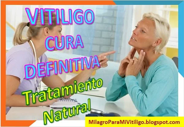 como-curar-el-vitiligo-tratamientos-caseros-remedios-naturales