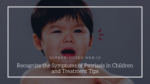 Recognize the Symptoms of Psoriasis in Children and Treatment Tips