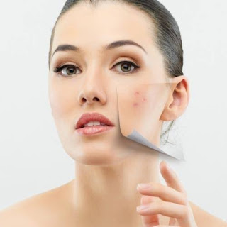how to remove pimple marks in one day home remedies how to remove dark spots caused by pimples pimples on face removal tips pimple marks removal cream how to remove pimples how to remove pimple marks for men home remedies for acne scars overnight how to remove pimple marks naturally for oily skin in one day