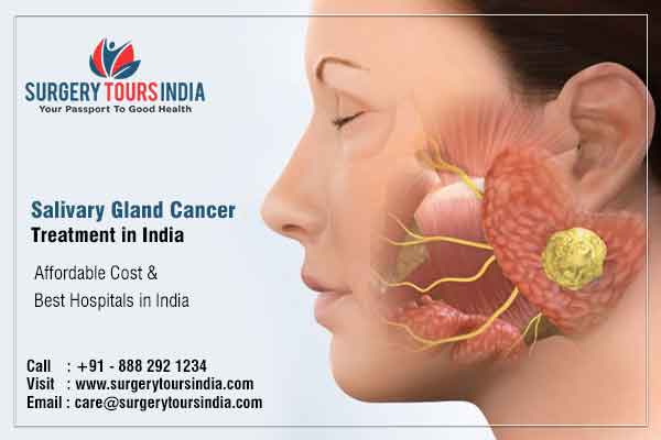 Salivary Gland Cancer Treatment India