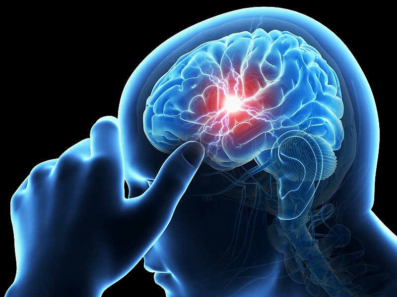 Obat stroke, obat herbal stroke, obat menyembuhkan stroke, obat menangani stroke, obat untuk stroke, obat alami stroke