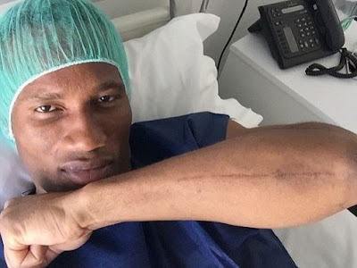 Photo: Drogba shows off metal plate scar on his arm as he prepares for surgery