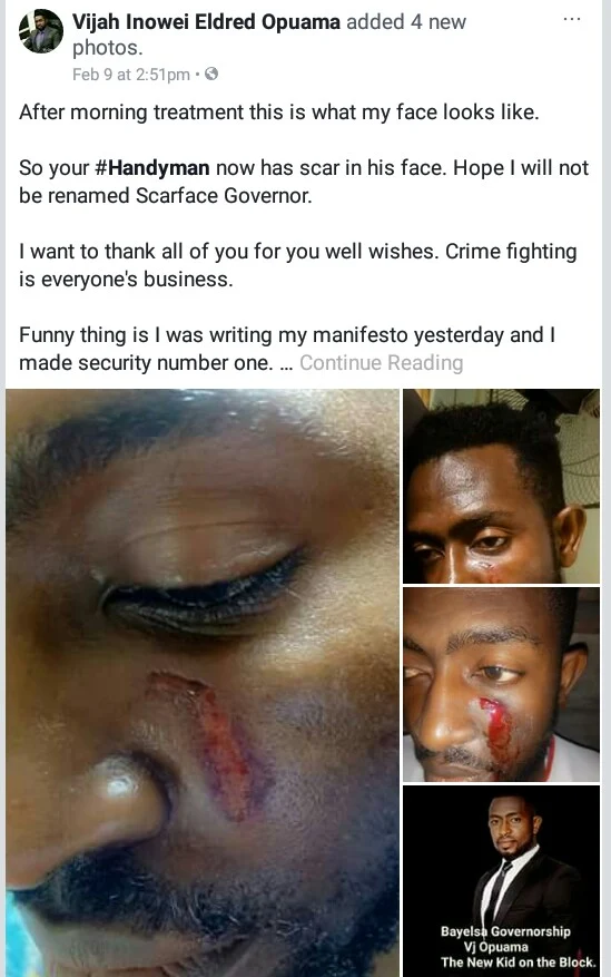  Photos: 36-year-old Bayelsa governorship aspirant allegedly attacked by suspected armed robbers