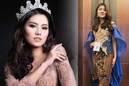 Daniella Grace Krestianto Hilangkan Stigma terhadap Kaum Difabel