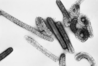 New Ebola Virus On The Rise: Marburg Virus Kills 3 In Uganda