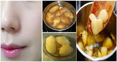 SOLUTION!! PERMANENT SKIN WHITENING WITH BOILED POTATO