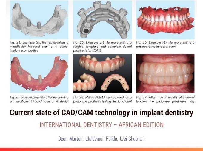 PDF: Current state of CAD/CAM technology in implant dentistry