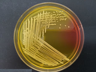 Mannitol Salt Agar Agar : Composition, Principle and Use