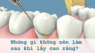 Tìm hiểu nguyên nhân viêm chân răng gây hôi miệng-1