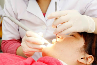 Răng cấm bị sâu có nên nhổ không?