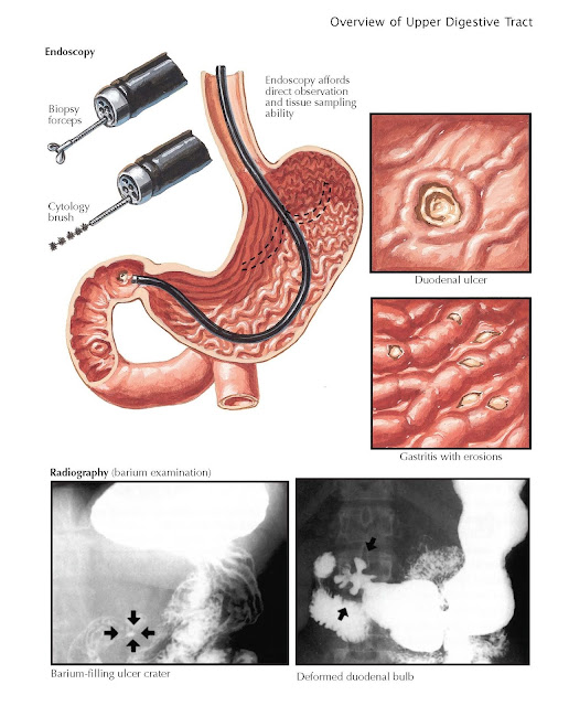 Histologic and Cytologic Diagnosis