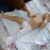 «Ռմբակոծությունից վիրավորված 2-ամյա Արծվիկը վիրահատվել է. բարդ վիրահատությունն անցել է լավ». ԲԿ-ի խոսնակ