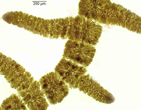 Batrachospermum internal
