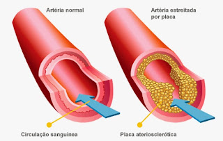 Bildergebnis für doenças do sistema cardiovascular