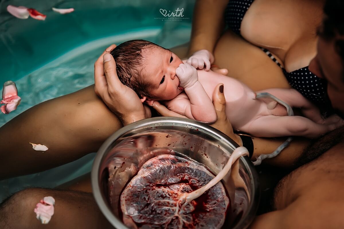 Mindblowing Images Of Childbirth From 2018 Winners Of Birth Photography Contest