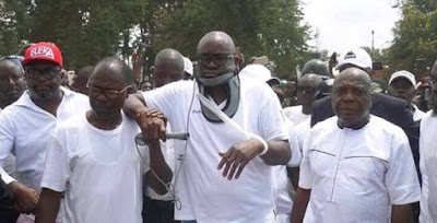 Doctor reveals new twist about Fayose’s ‘injuries’