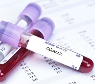 الكالسيتونين calcitonin